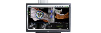Navigation Guided Surgery | Dentist